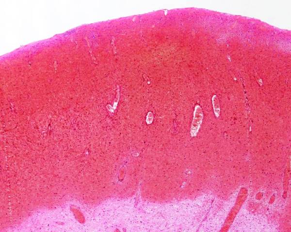Pictures of vulva with polyps that Can look pictures of vulva with polyps